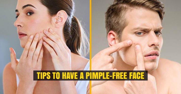 Tips to Have a Pimple-Free Face