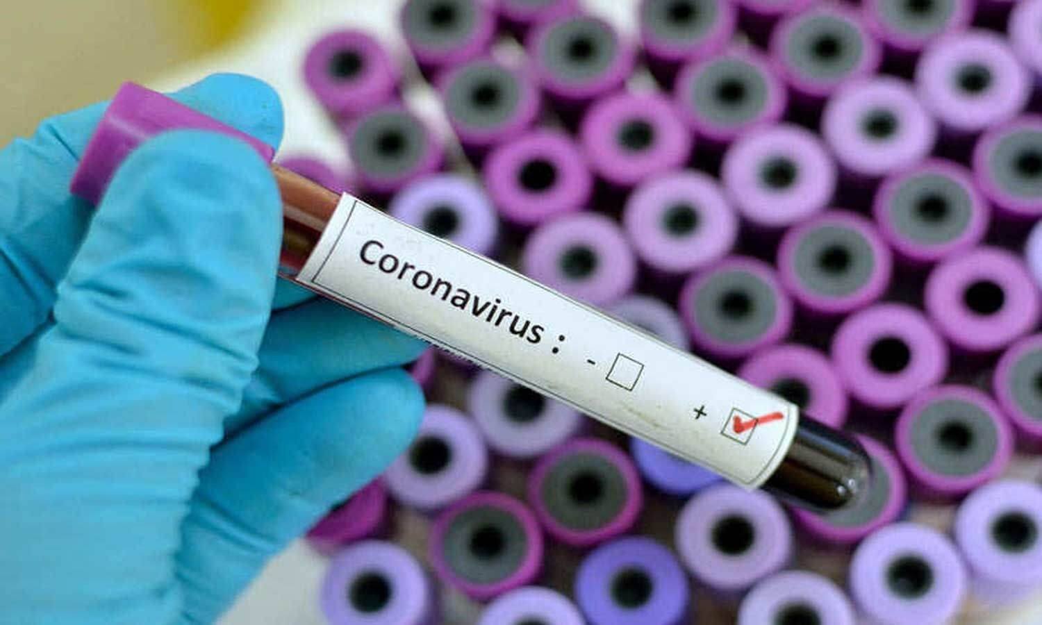 Do’s and Don’ts to Protect Yourself from Coronavirus